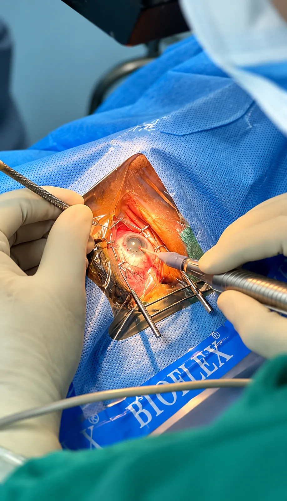 Close view of ophthalmic surgical equipment